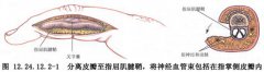 巨指症产生的原因是什么呢?